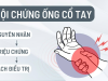 Hội chứng ống cổ tay : triệu chứng, nguyên nhân và cách điều trị hiệu quả 