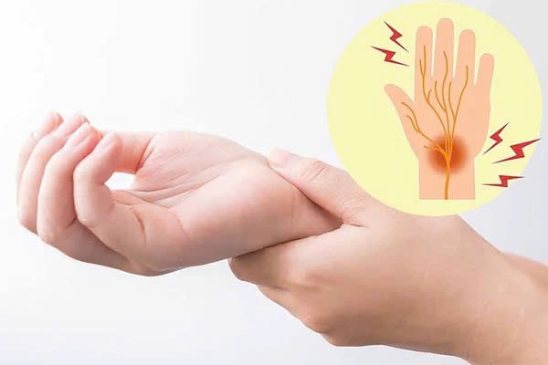 Teo cơ bàn tay do hội chứng ống cổ tay kéo dài không điều trị